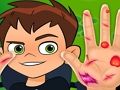 Spiel Ben10 Handarzt  Online