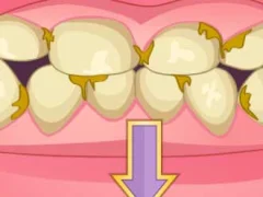 Bad Teeth Makeover – kostenloses Online-Spiel