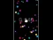 Pop Ball – kostenloses Online-Spiel