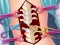 Anna Scoliosis Surgery – kostenloses Online-Spiel