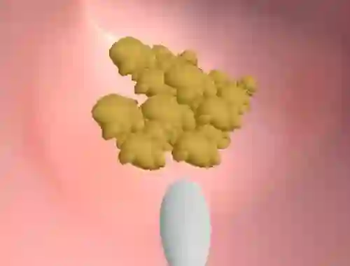 Earwax Clinic – kostenloses Online-Spiel