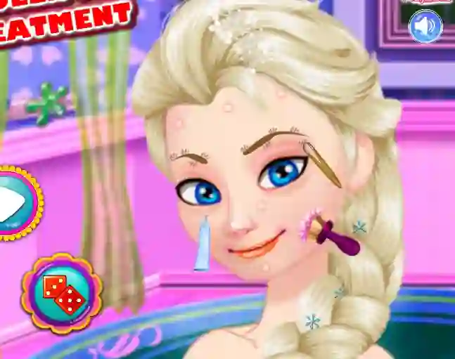 Ice Queen Acne Treatment – kostenloses Online-Spiel
