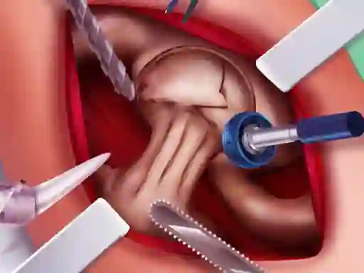 Princess Hips Surgery – kostenloses Online-Spiel
