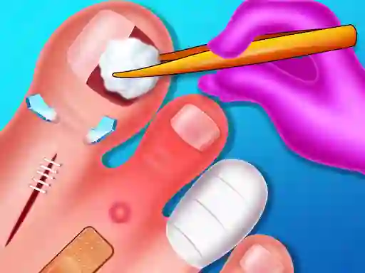 Funny Nail Doctor – kostenloses Online-Spiel
